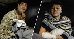  Ukraine captures two injured North Korean soldiers in Russia 