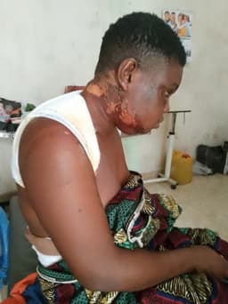 Couple in police net for pouring widow hot water