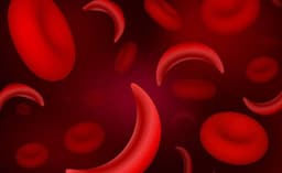 Nigeria records highest cases of sickle cell globally