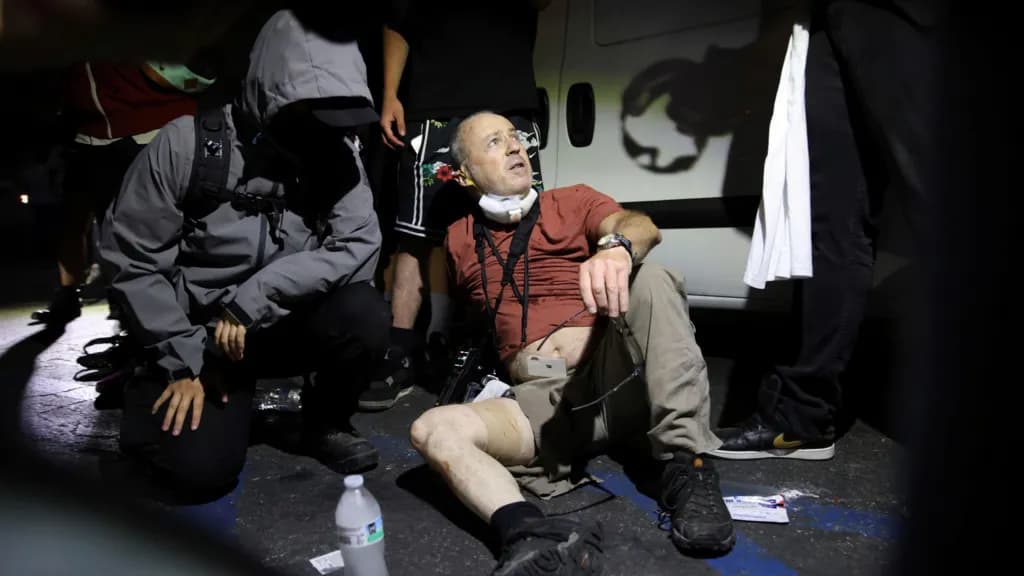 British photographer injured by 'plastic bullet' in LA protests