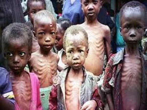 3.5 million Nigerian children suffering severe acute malnutrition — UNICEF