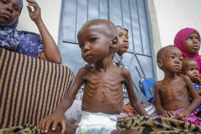 MSF laments as number of malnourished children balloons in Kebbi