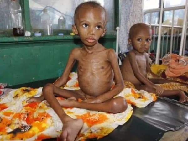 Surge in child malnutrition in Northern Nigerian worrisome — Nwabueze