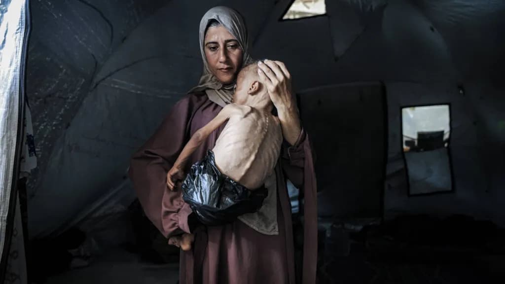 Gazans 'wasting away' as mass starvation spreads, humanitarian groups warn