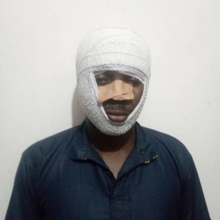 ‘This was attempted murder’: Edo Activist Okhai Okhani speaks out after brutal attack