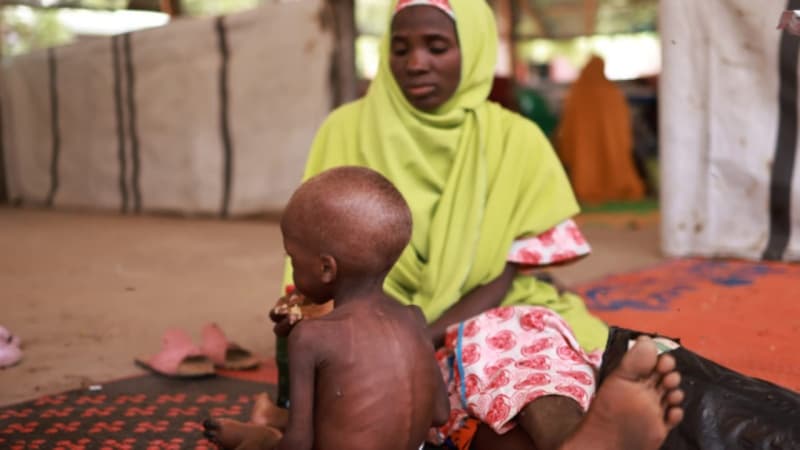 Nigeria loses over $1.5bn to malnutrition annually — FG