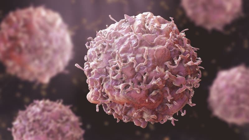Diabetes fuels more aggressive breast cancers – Study 