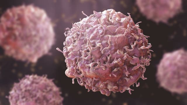 Diabetes fuels more aggressive breast cancers ? Study 