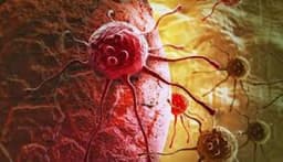 Global cancer toll to rise by 61 per cent in 2050 — Report
