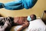 Tuberculosis killed 1.23 million globally in 2024 ? WHO