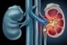 230,000 Nigerians in need of kidney transplant ? Don