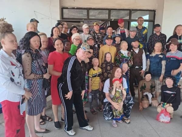 Albinism Network calls for inclusiveness