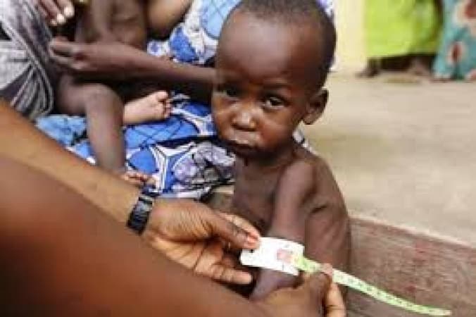 UNICEF raises alarm as child malnutrition soars in Ebonyi