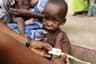 UNICEF raises alarm as child malnutrition soars in Ebonyi