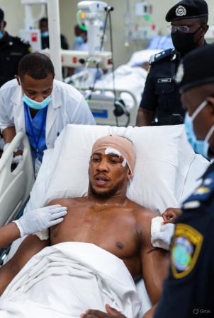 British envoy, govs visit Anthony Joshua in Lagos hospital