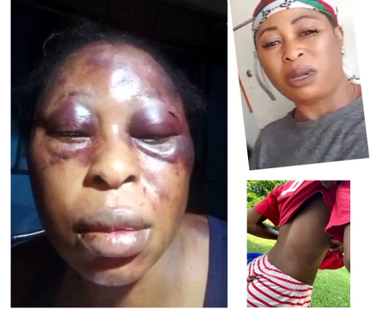 Mother of three brutally attacked by neighbors over prepaid meter’s recharge cries for Justice