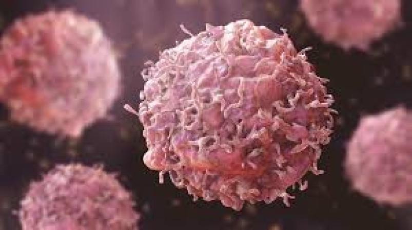 Nigeria records 128,000 new cancer cases yearly — FLAC