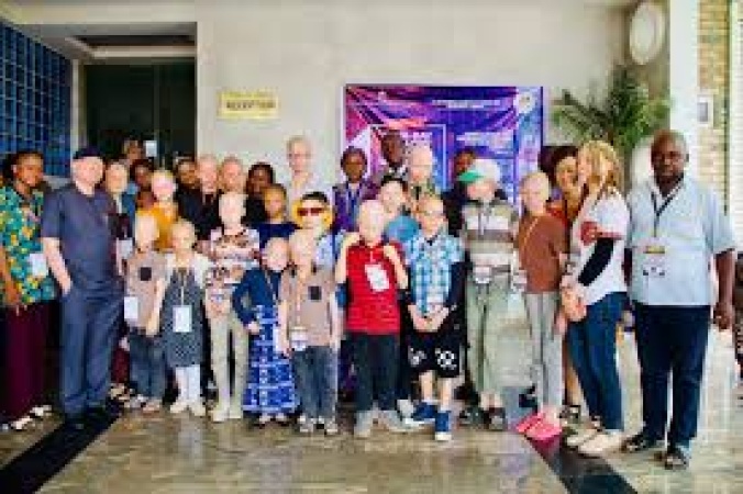 Albinism Association offers free medical services to members in Abuja