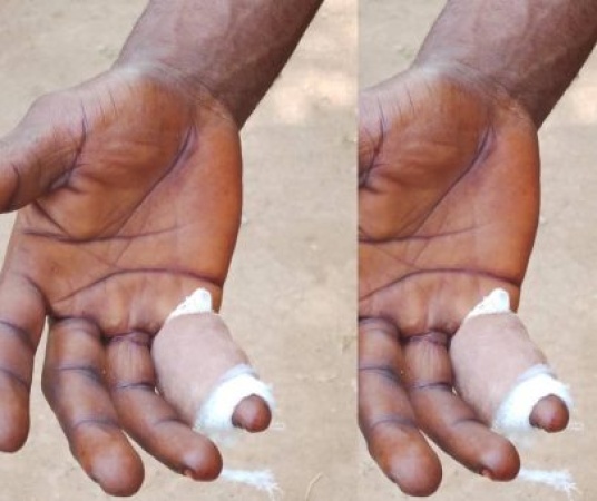 Two injured as APC, Accord Party members clash during INEC’s CVR exercise in Osun