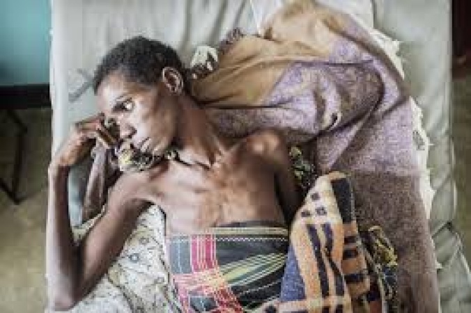 Lagos, Benue lead as Nigeria reports 20,838 new HIV cases