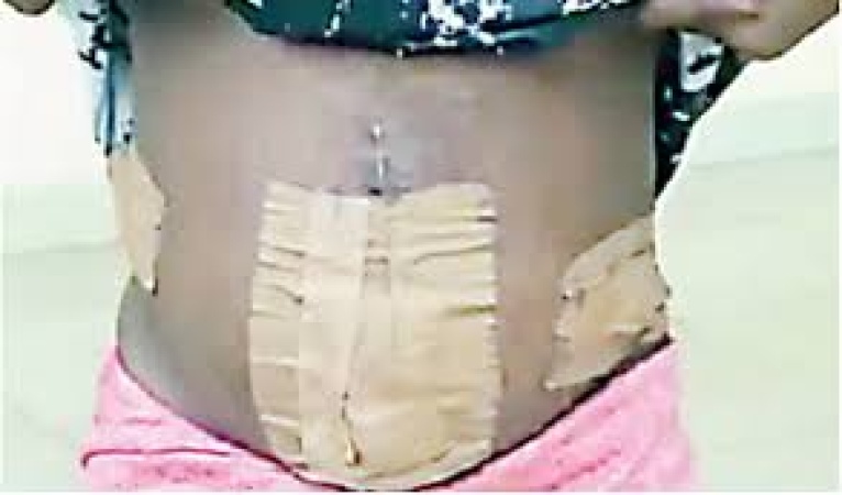 How human traffickers removed teenager’s fallopian tubes for commercial s3x work in Ivory Coast