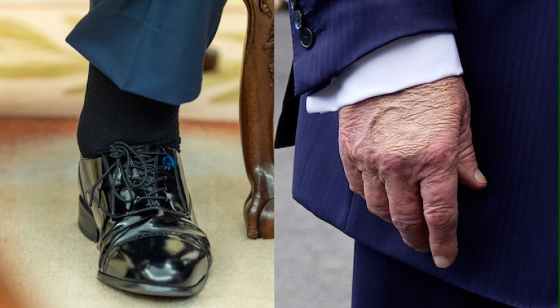 White House doctor says Trump fit for duty despite leg swelling, hand bruising