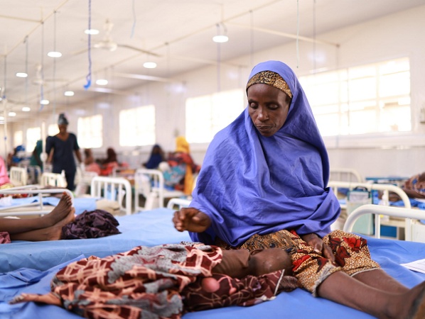 Experts raise alarm over hospital malnutrition in Nigeria, say up to 45% of patients affected 
