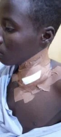Kaduna teen survives attack, lauds Army Hospital’s life-saving treatment