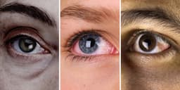 What the colour of your eyes says about your health