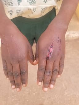 Woman inflicts razor blade wounds on 10-year-old boy for stealing N600