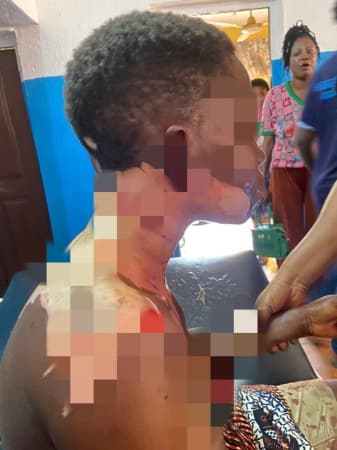 Man pours hot oil on wife, stabs her in the head during domestic dispute