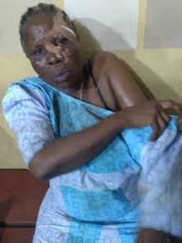 Osun: Three injured in APC, PDP clash after Supreme Court ruling