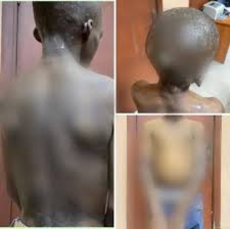 Lagos nabs mother for torturing 11-year-old son